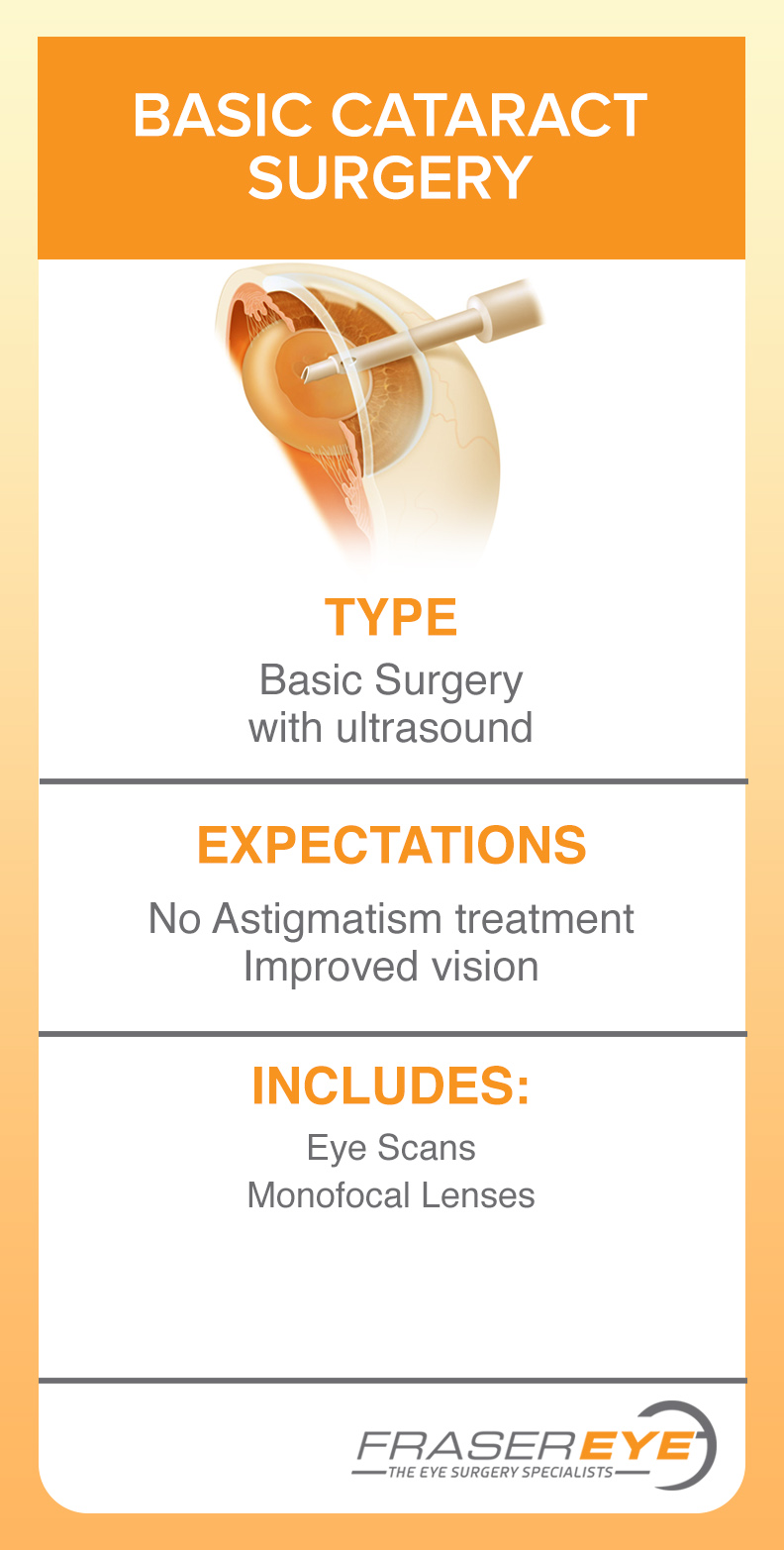 Cataract Implant Options At Fraser Eye Care Center Detroit